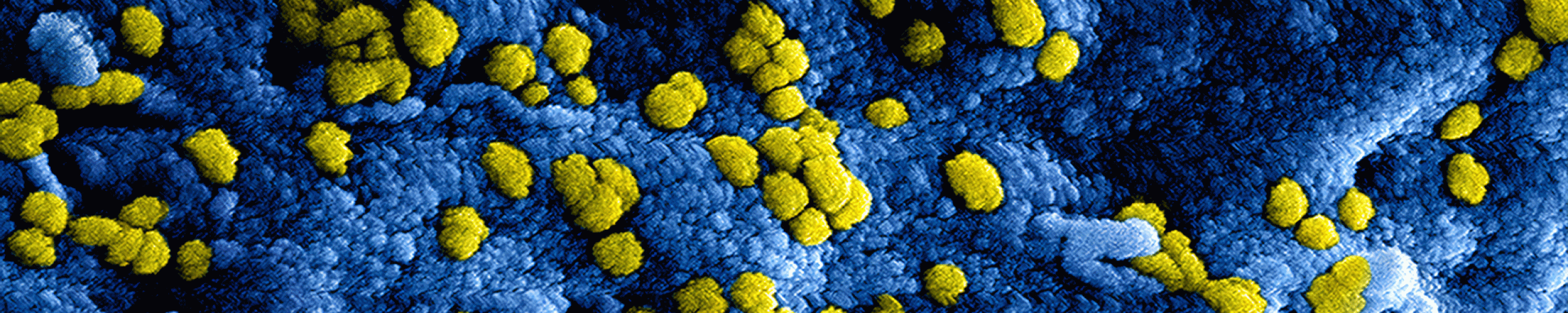 Corona virus